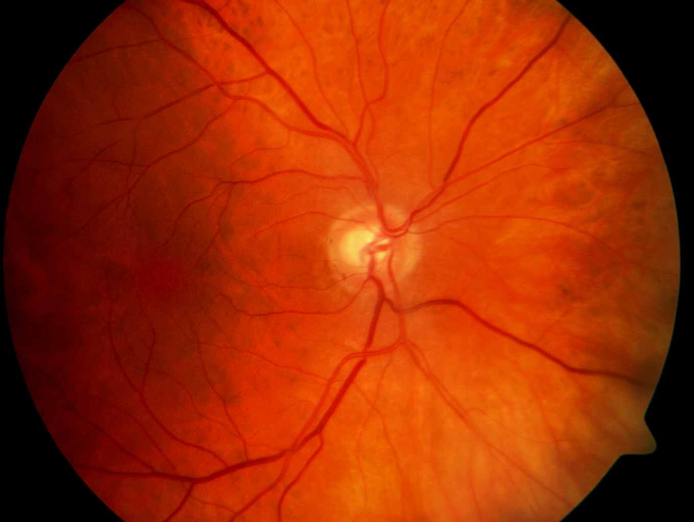 Fundus Fundus